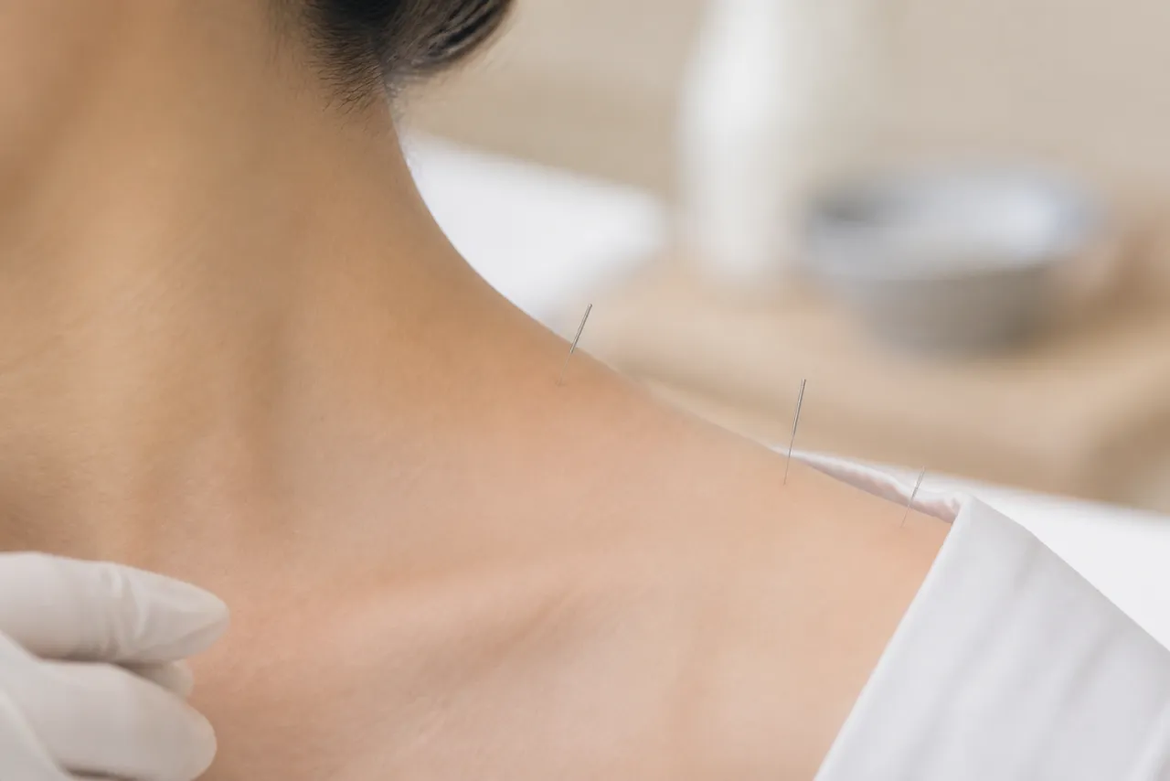 목과 어깨 경계에 놓인 침 — 경희미르애한의원 직장인 목·어깨 통증 치료